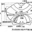 小腦皮質變性