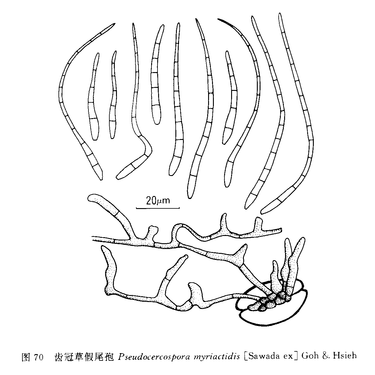 齒冠草假尾孢