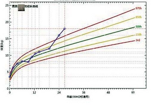 超越曲線