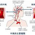 中風預報