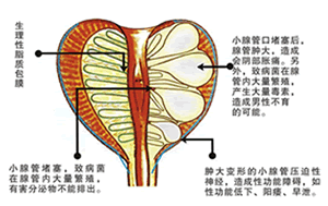 南京前列安通膠囊