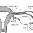 先天性宮頸閉鎖