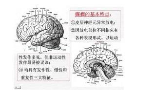 癲剋星膠囊