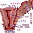 人流子宮出血