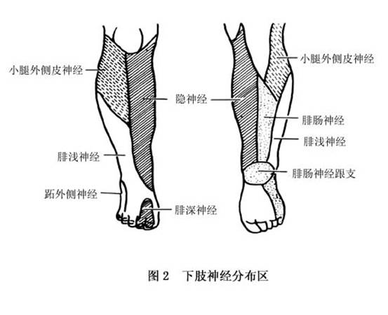 大腿以下或膝以下肌肉癱瘓