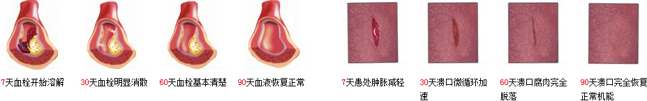 脈活靜脈曲張修復液