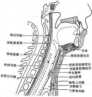 椎前間隙