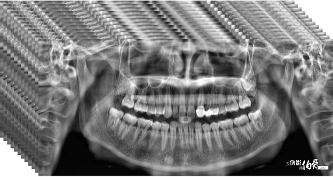 伯爵CBCT