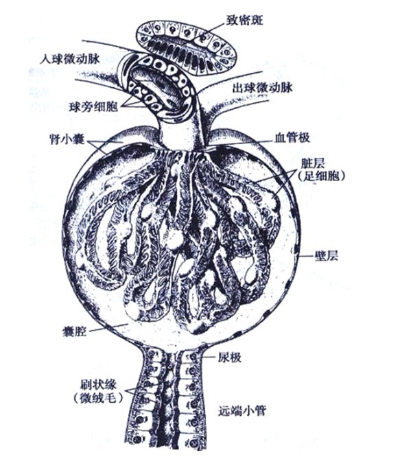 多發性感染後腎小球腎炎