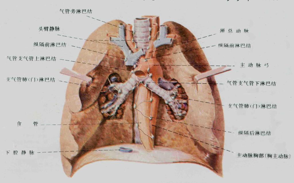 開放性肺結核