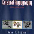 腦血管造影診斷Diagnostic Cerebral Angiography