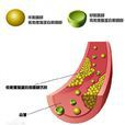 低密度脂蛋白膽固醇