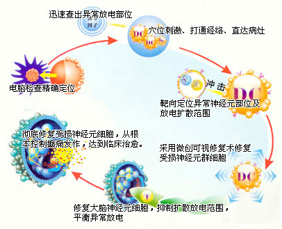 美國超聲納米-NGF定位修復療法