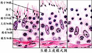 無精子症