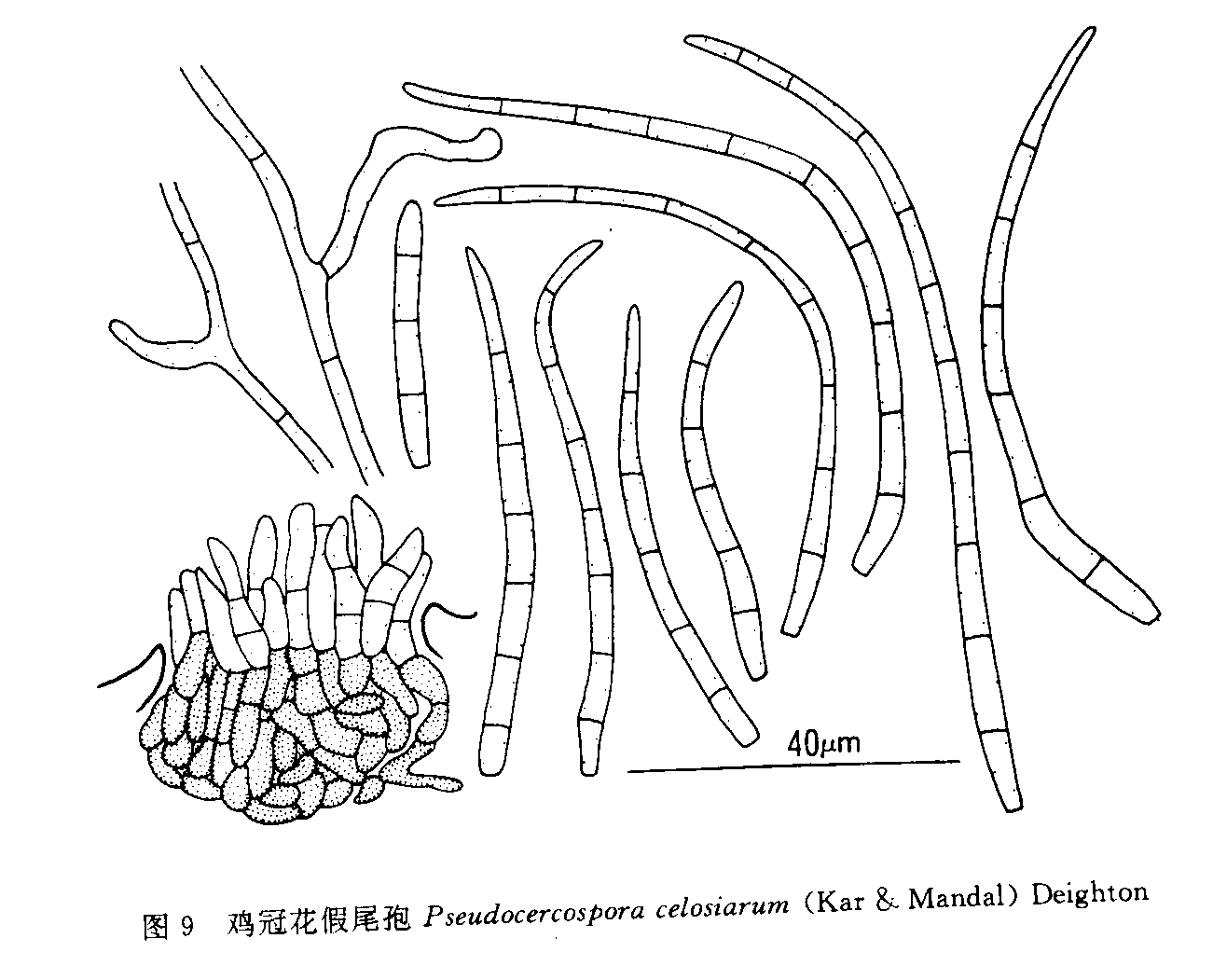 雞冠花假尾孢