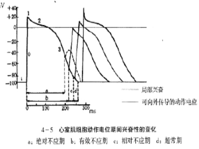 搶先占領