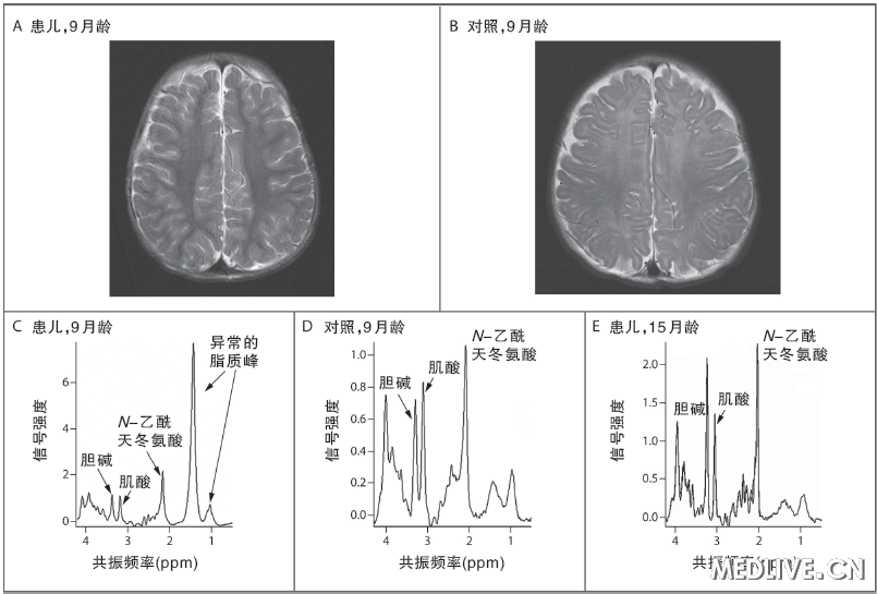 非致死性急性毒性