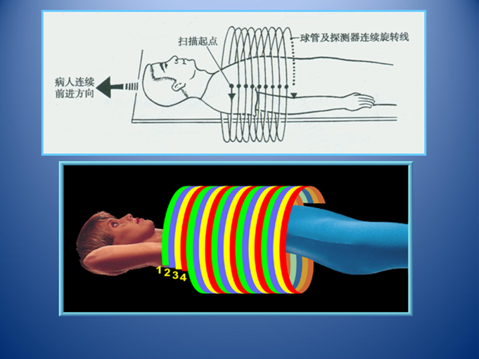 計算機體層成像