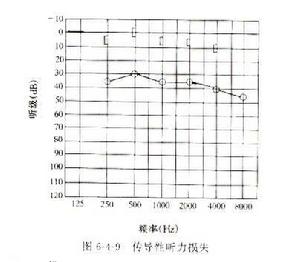 耳硬化檢測曲線圖