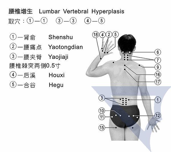 脊椎骨性關節病