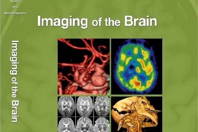 Imaging of the Brain