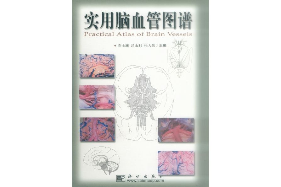 實用腦血管圖譜(2002年科學出版社出版的圖書)