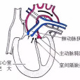 法洛四聯症(法樂四聯症)