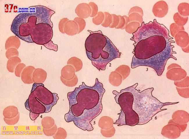 顱骨惡性腫瘤