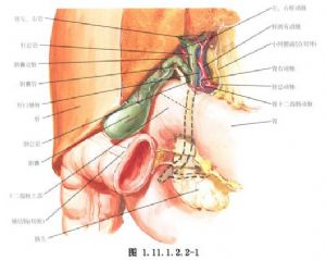 逆行膽囊切除術