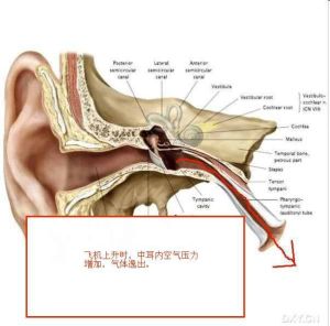 咽鼓管堵塞