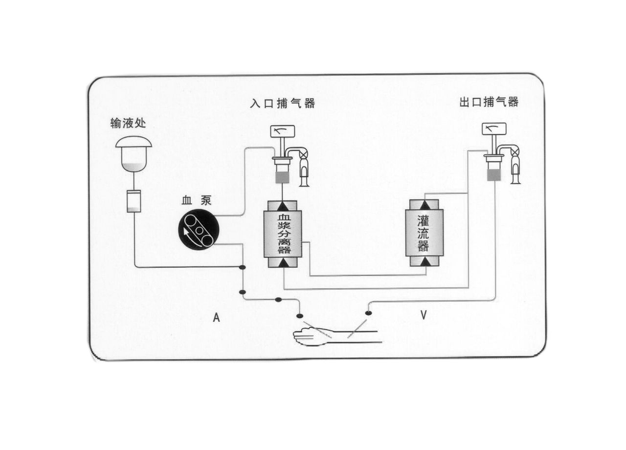 血漿吸附