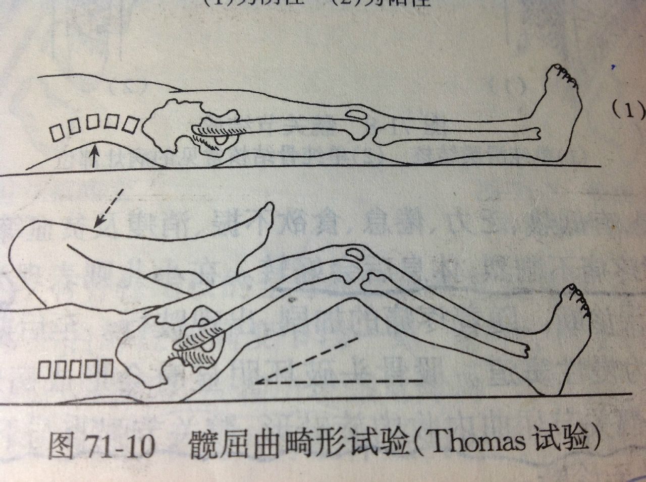 托馬斯征