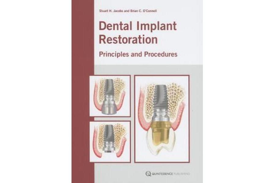 Dental Implant Restoration