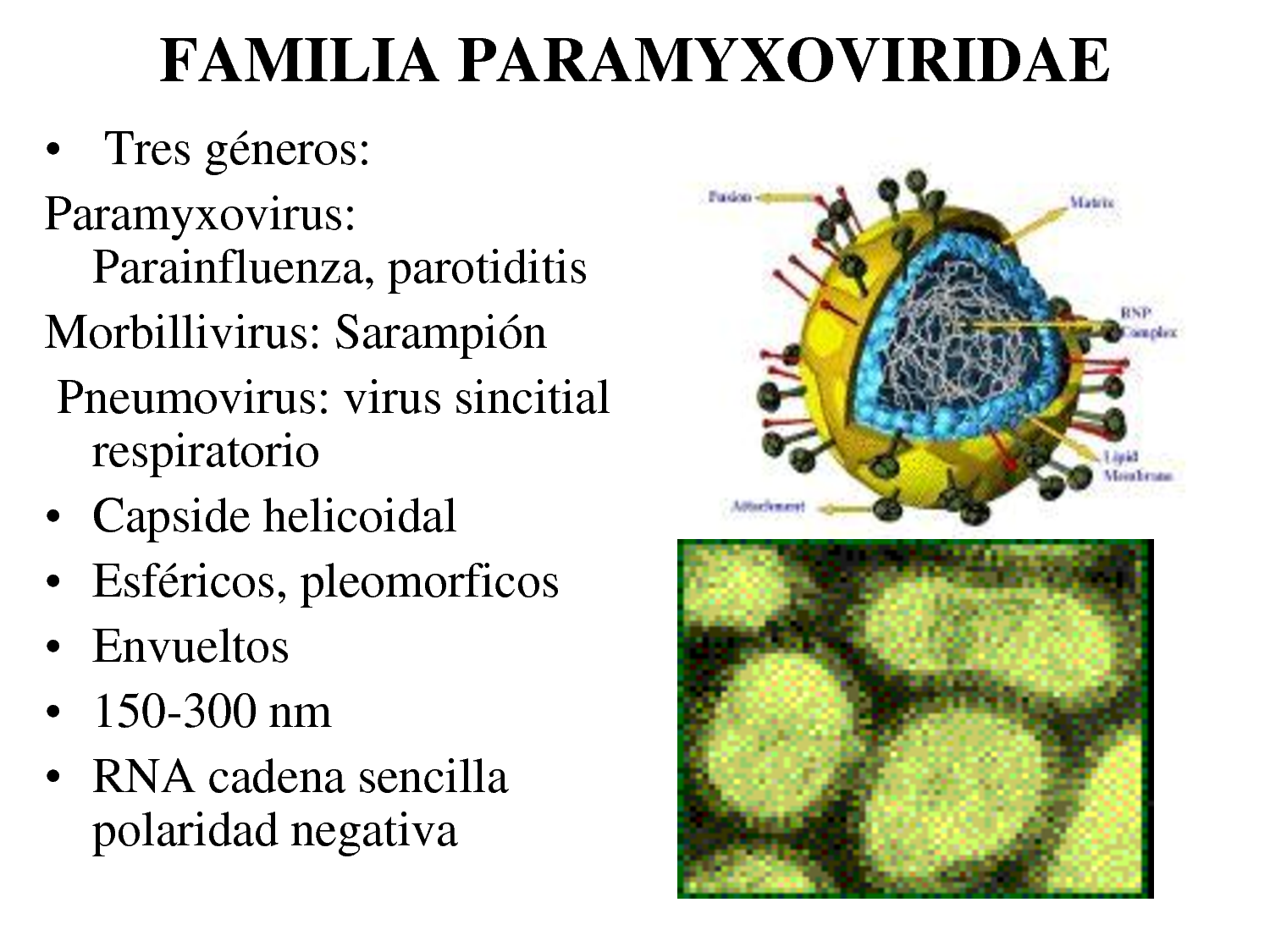 Paramyxoviridae