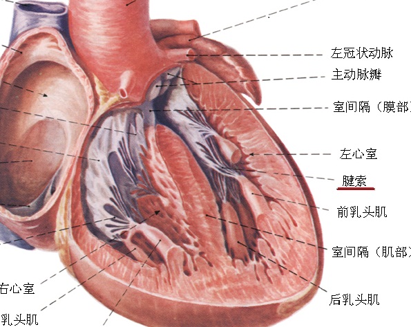 左室假腱索