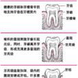 戰壕口炎