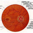 老年眼底動脈硬化