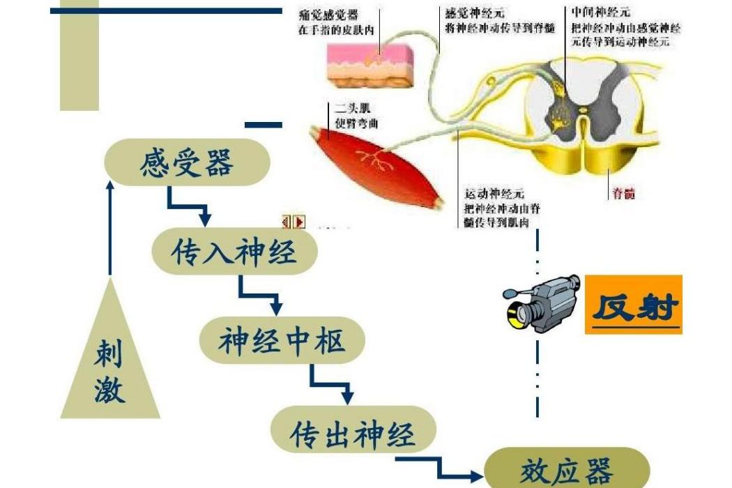 強直感受器