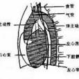 懸垂型心臟