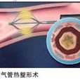 支氣管熱整形系統