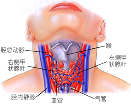 甲狀腺毒征