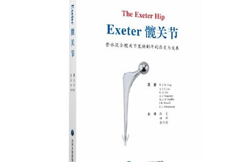 Exeter髖關節