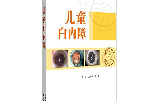 兒童白內障(2015年天津科技翻譯出版公司出版的圖書)