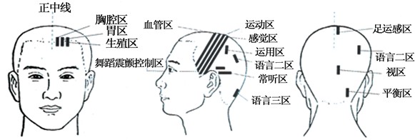 磁性頭皮梳