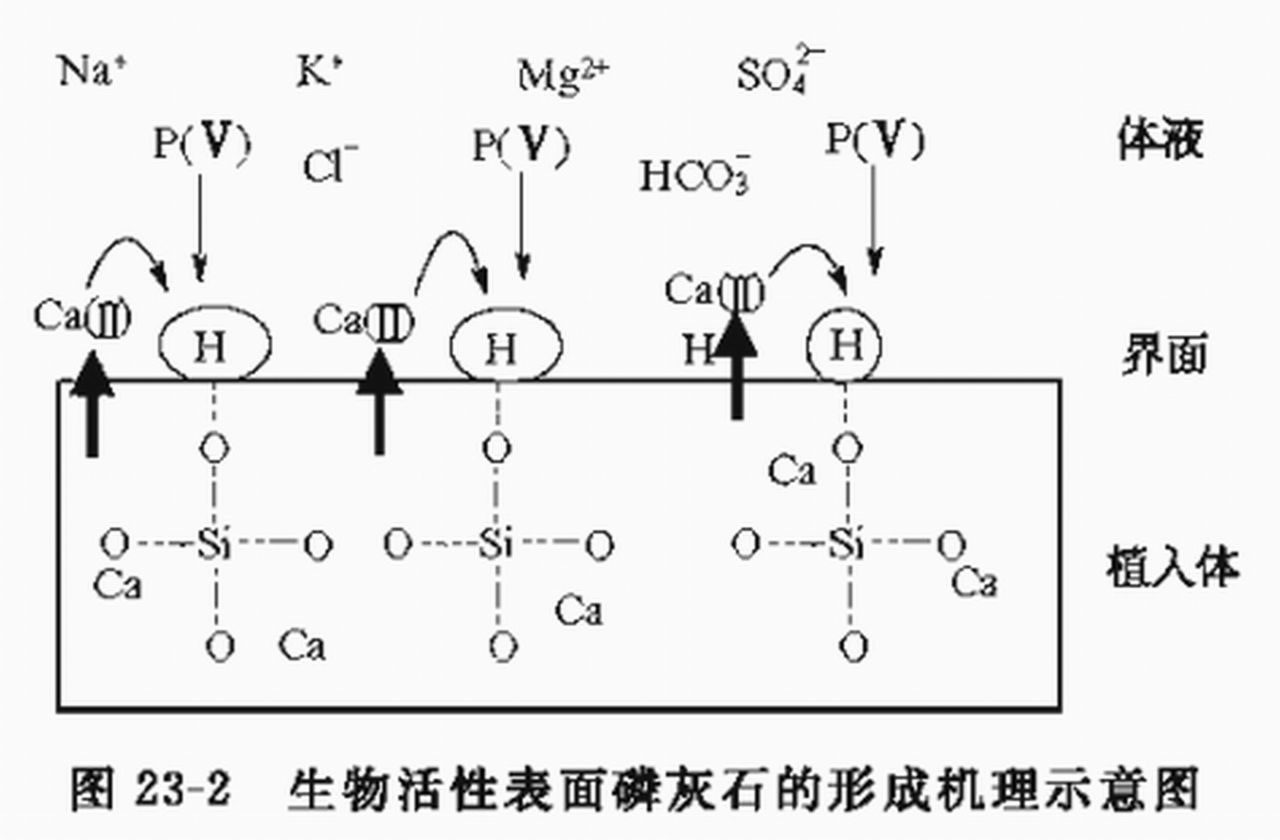 45S5生物活性玻璃