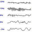 腦電信號分析