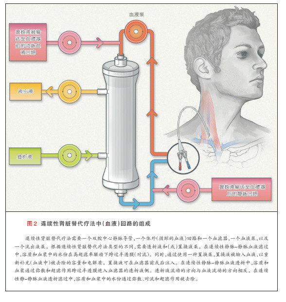 連續腎臟替代療法