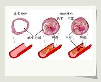 個體化治療