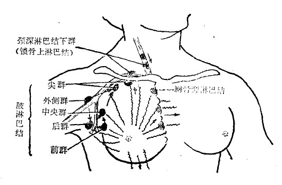 淋巴結反應性增生