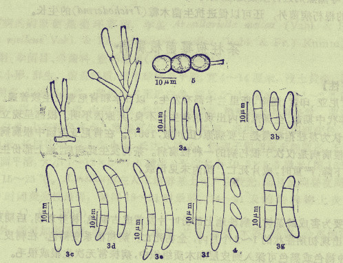 病菌分析圖